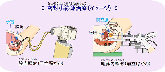 食事のイラスト